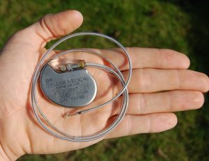 Scientists develops First Biological Pacemaker using Human Stem Cells
