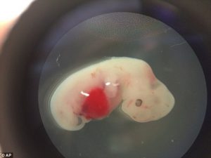 US Based Scientists Develops Human-Pig Hybrid