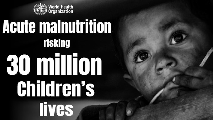 Acute malnutrition risking 30 million children’s lives