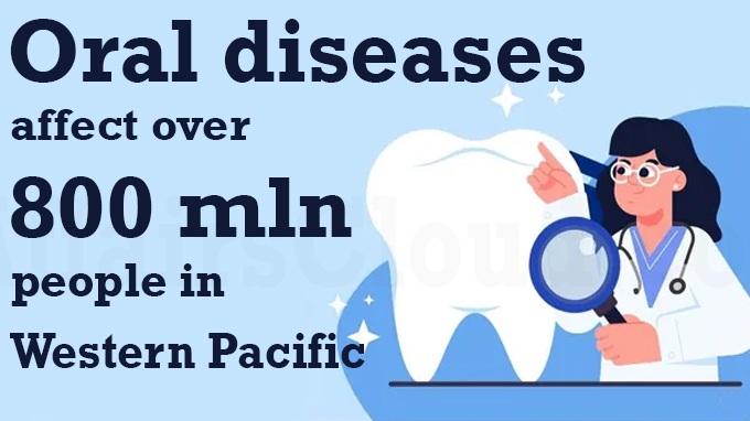 Oral diseases affect over 800 mln people in Western Pacific